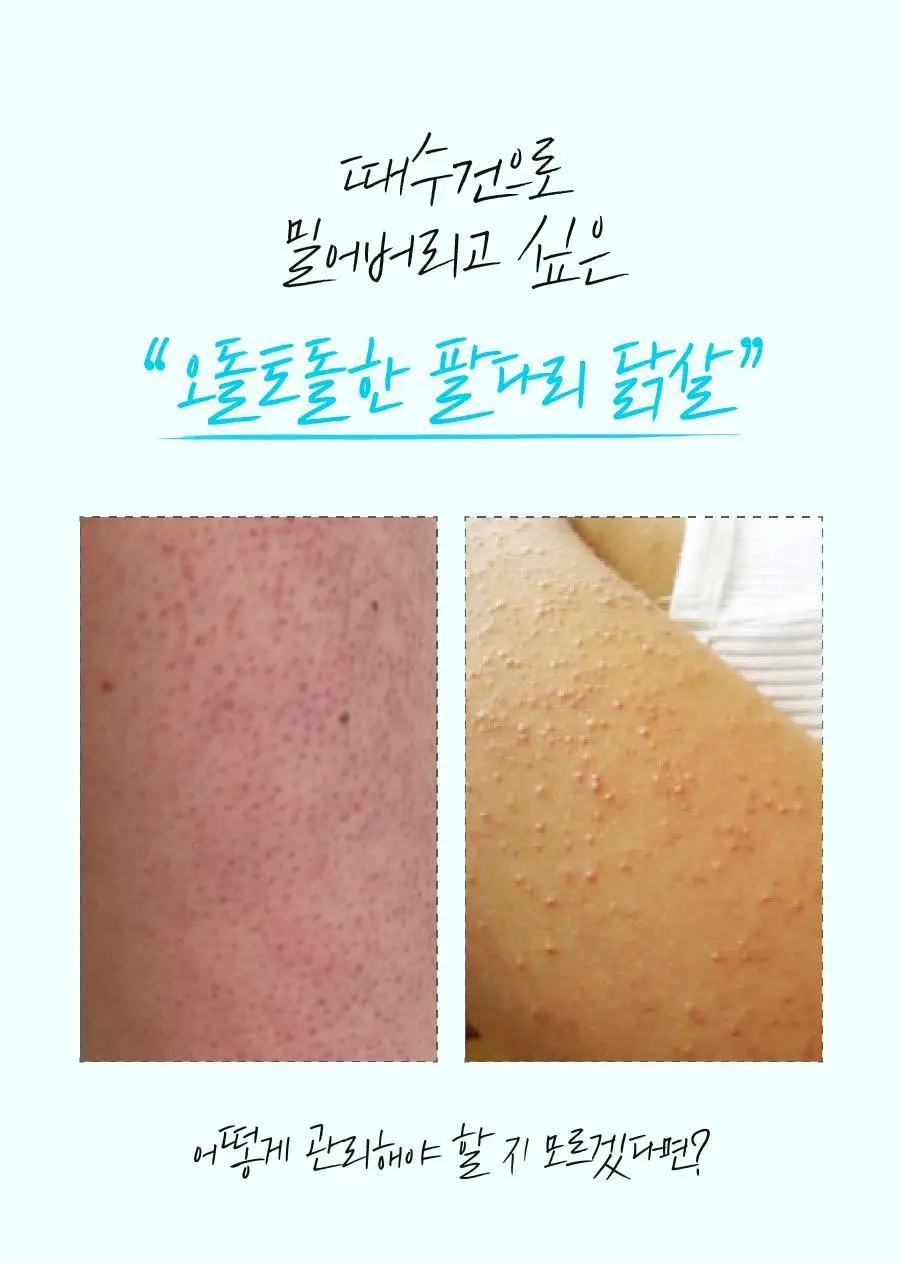 [모공&각질개선] 씨퓨리 바디미스트 200ml NEW 상세페이지 5